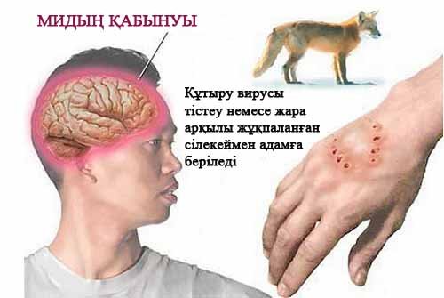 Құтыру  ауруы дегеніміз не? 