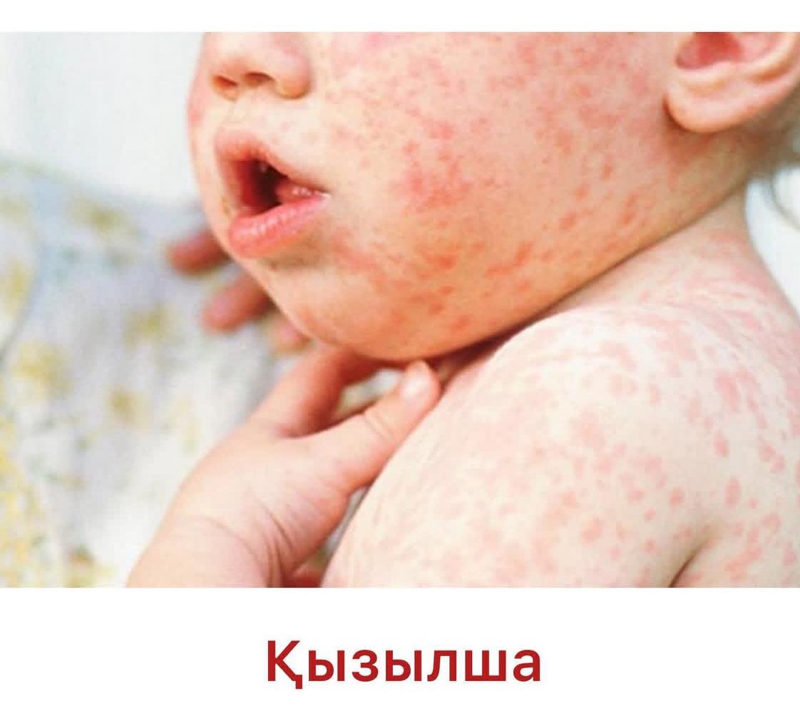 Қызылшаның  белгілері